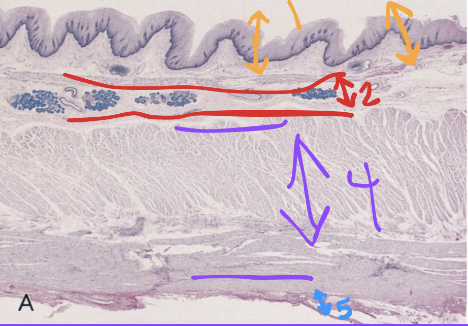 <p>what’s the wall layer at 5</p>