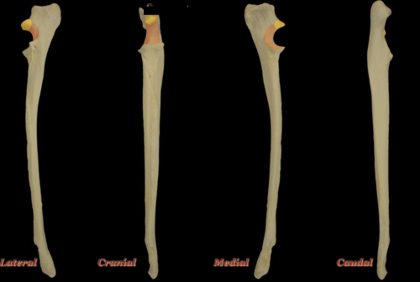 <p>What structure is highlighted yellow in this picture?</p>