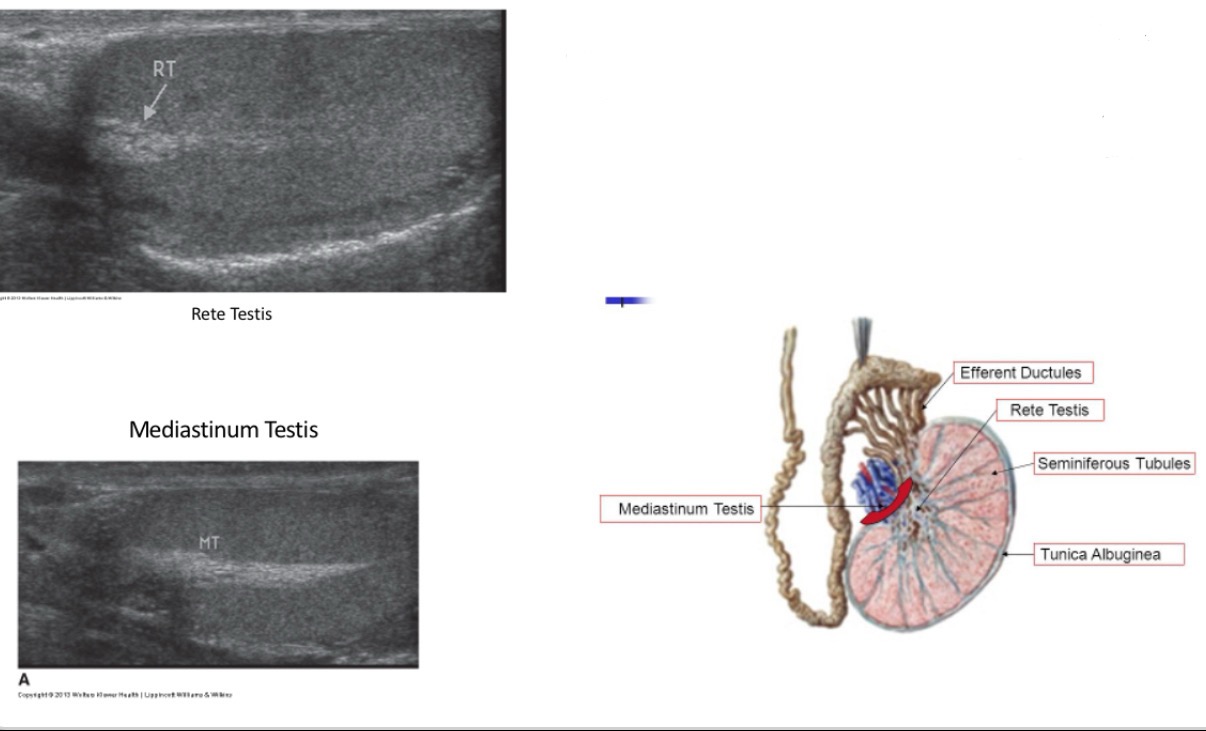 <p>The _______ is an anastomosing network of delicate tubules located in the <strong>hilum</strong> of the testicle (<strong>mediastinum testis</strong>) that carries sperm from the seminiferous tubules to the efferent ducts. The efferent ductules carry the seminal fluid from the ______ to the epididymis.</p>