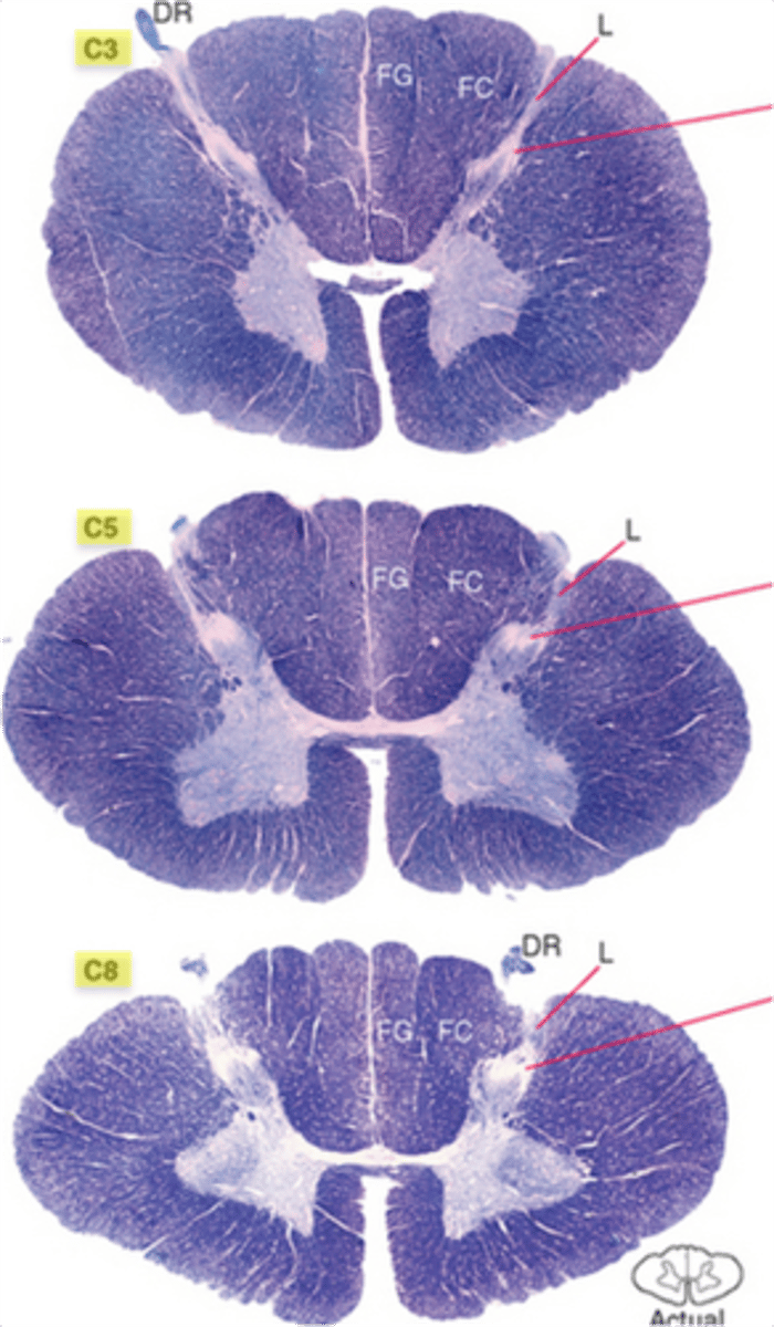 <p>cervical; cervical enlargement at C4-T1</p>