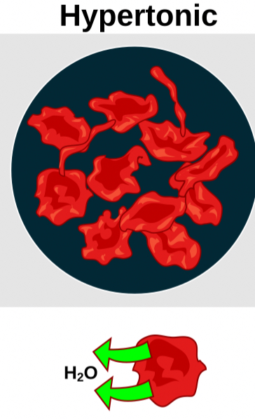 <p>is one that has a higher solute concentration outside the cell than inside.</p>