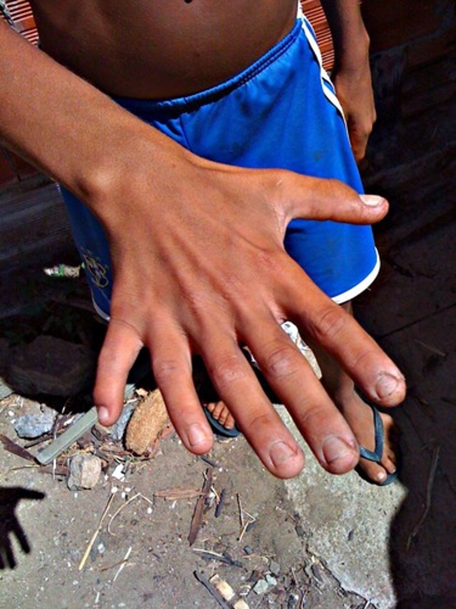 <p>deviation from what is normal</p>