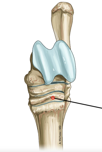 <p>Third distal tarsal; supports Mt3.</p>