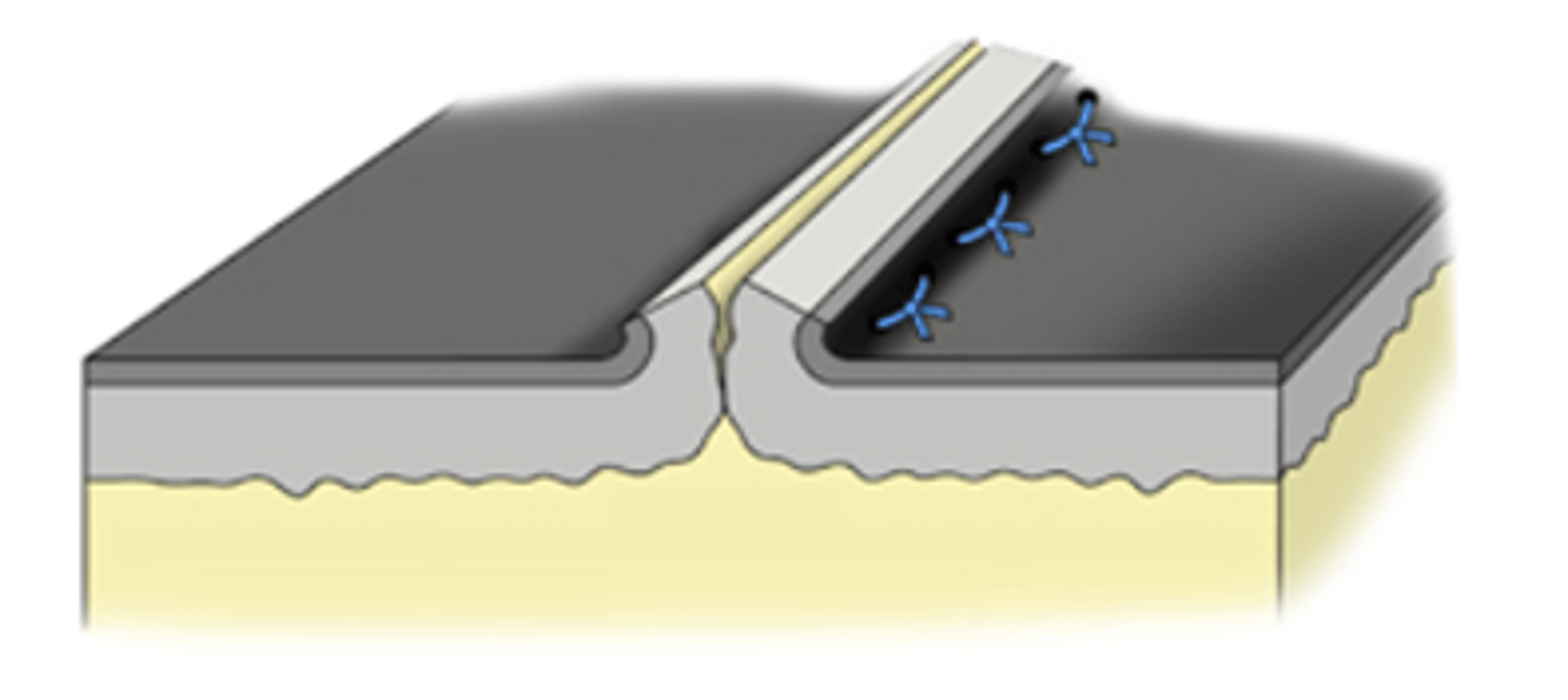 <p>- The edges of the incision roll outwards</p>