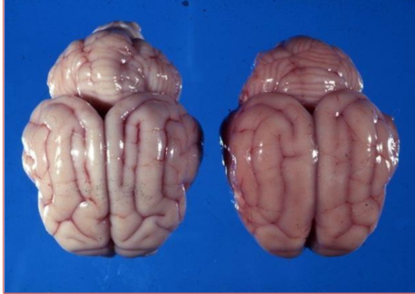 <p>What does the brain on the right have here? It's subtle but how can you tell?</p>