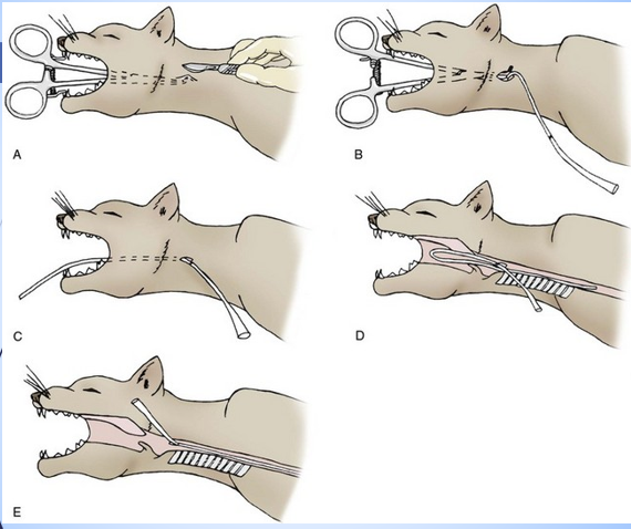 <ul><li><p>Surgically prep the area - measure the tube </p></li><li><p>Measure the feeding tube to the 7th to 8th intercostal space and mark the length </p></li><li><p>Placed curved artery forceps into the mouth and down the oesophagus - incise over the end of the forceps </p></li><li><p>Grip the end of the feeding tube with the forceps through the incision and draw this out through the mouth </p></li><li><p>Redirect the feeding tube down into the oesophagus until it reaches the marker made </p></li><li><p>Secure in place with a Chinese fingertrap suture </p></li></ul><p></p>