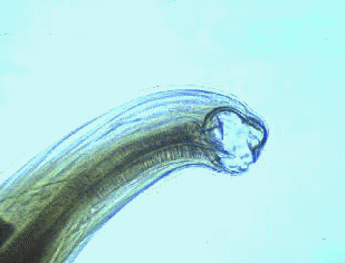 <p>- Type of parasitic nematode</p><p>- Infects 1 billion people worldwide</p><p>- Affects 1/5 of the worlds population</p><p>- Part of the top 3 of parasitic disease in humans</p><p>- Leads to fatigue, anemia, and iron deficiencies</p><p>- Found in rural areas with poor sanitation</p><p>- Found in Southeastern US (Alabama)</p><p>- Unusual lifecycle</p><p>- Likes warm climates</p><p>- Women and children affected the most</p><p>- Juveniles can burrow into the skin</p>