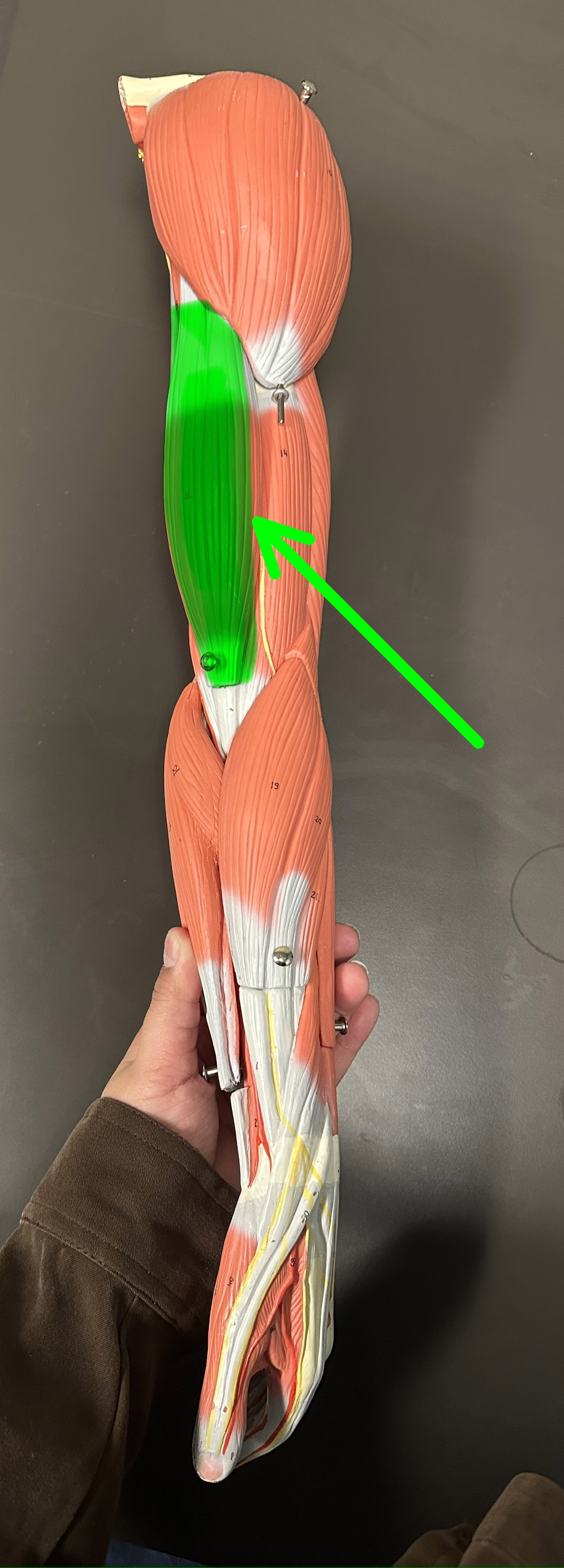 <p>What is the highlighted structure</p>