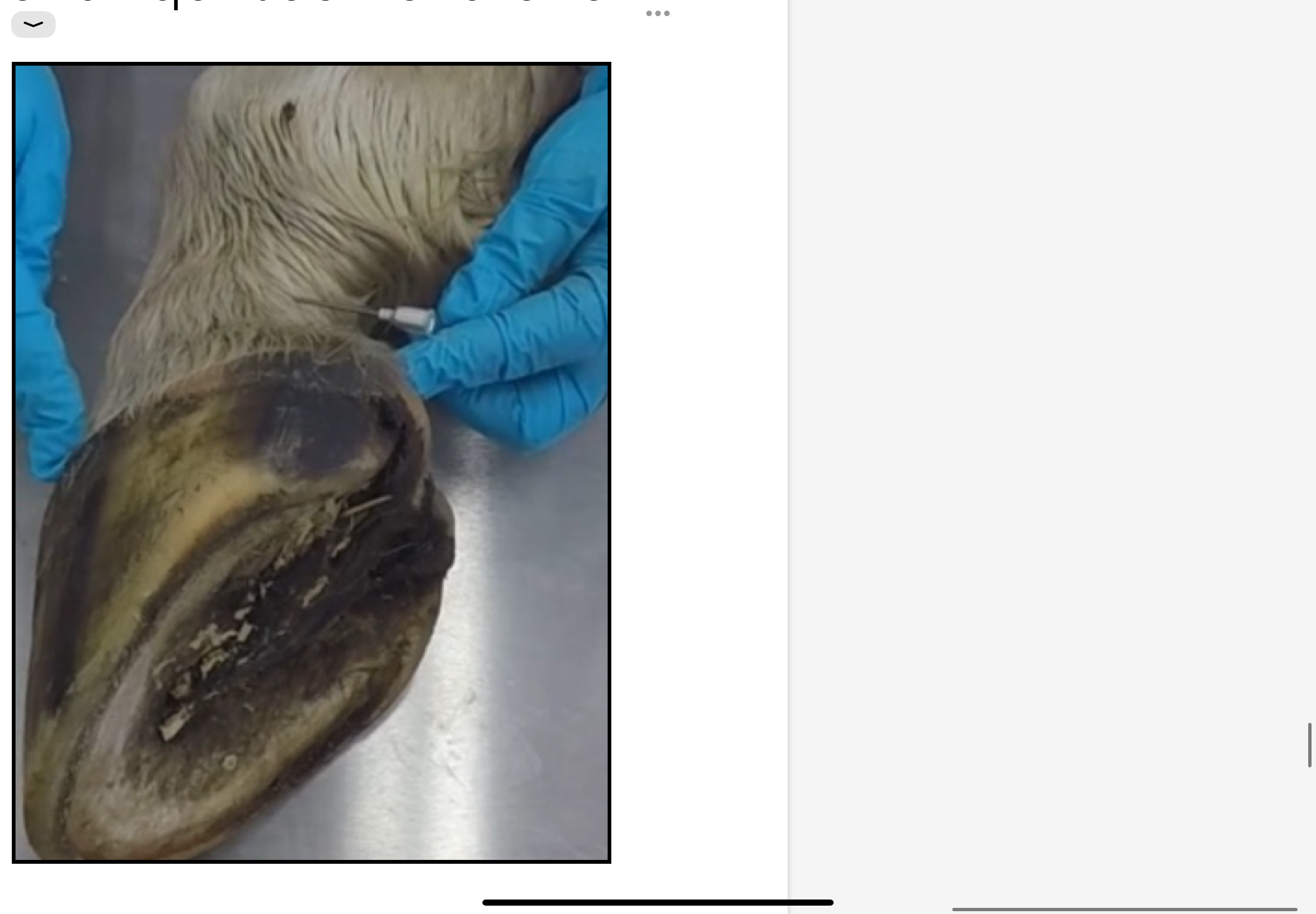 <p>Anesthésie du nerf digité postérieur :</p><p>- Anesthésie toutes les structures profondes du pied. Donc un cheval qui souffre d’une maladie naviculaire va répondre très positivement à cette anesthésie (il ne boitera plus du tout le temps de la durée d’action de l’anesthésique local).</p><p>Procédure: Il y a différentes structures à prendre comme repère : l’ergot (quand on tire sur celui-ci, on tend les ligaments de l’ergot, médial et latéral) et le ligament de l’ergot. Pour anesthésier le nerf digité postérieur, il faut piquer sous le ligament de l’ergot, à mi-distance entre l’ergot et la muraille. On injecte l’anesthésiant dans la zone du nerf digité postérieur, ce n’est pas nécessaire de piquer sur le nerf, l’anesthésique va diffuser. Toujours aspirer avant de piquer pour être sûr de ne pas piquer dans l’artère car sinon l’anesthésique va être diffusé dans la circulation sanguine et la zone ne sera pas anesthésiée. Après avoir anesthésié le nerf, on attend 5 minutes puis on fait trotter le cheval. Si le cheval ne boite plus, on sait que l’origine de la douleur est située dans une de ces structures profondes du pied.</p>