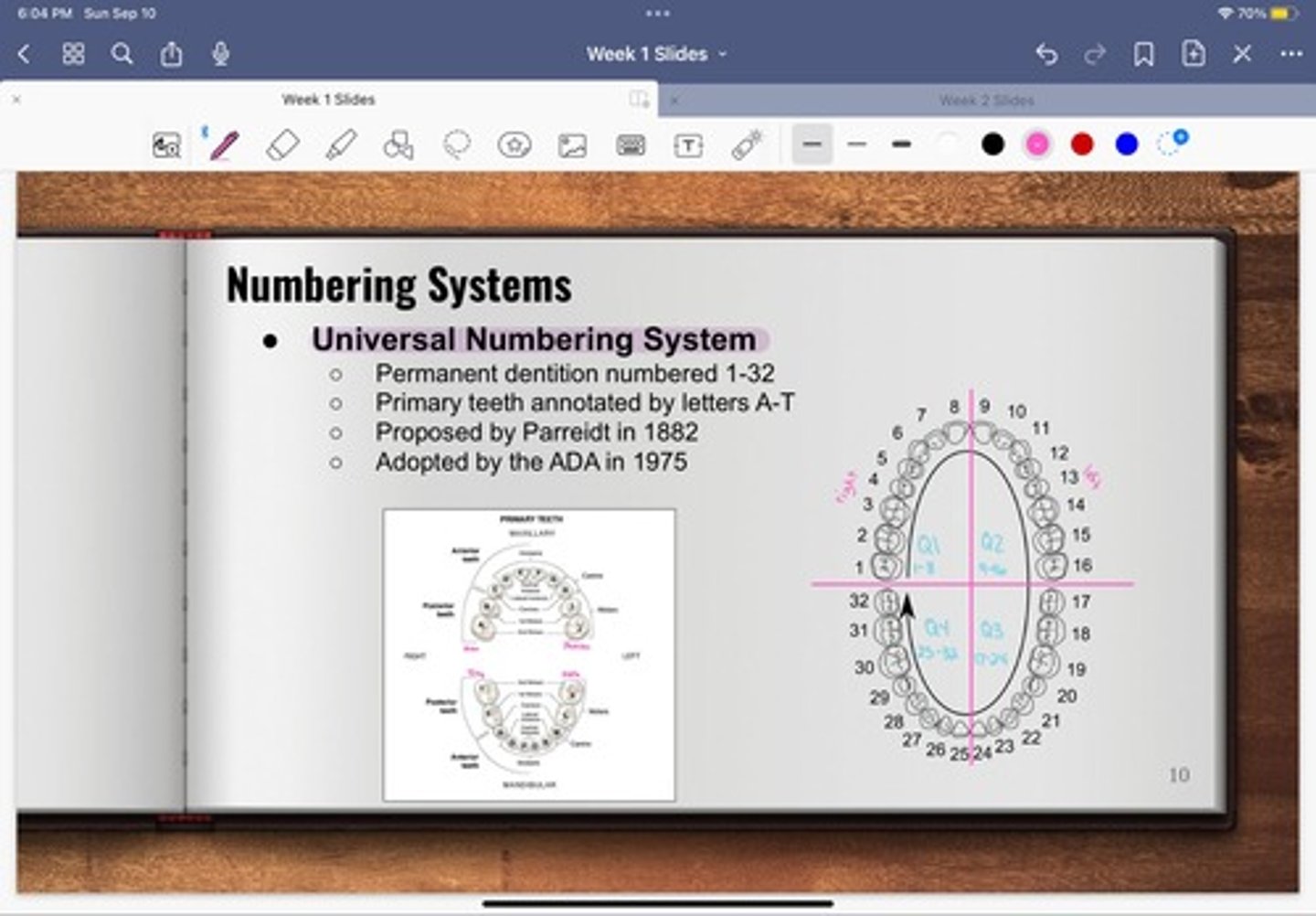 <p>-permanent dentition numbered 1-32</p><p>-primary teeth annotated by letters A-T</p>
