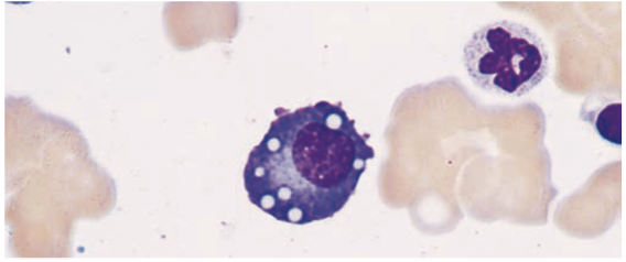 <p>Plasma Cells </p>
