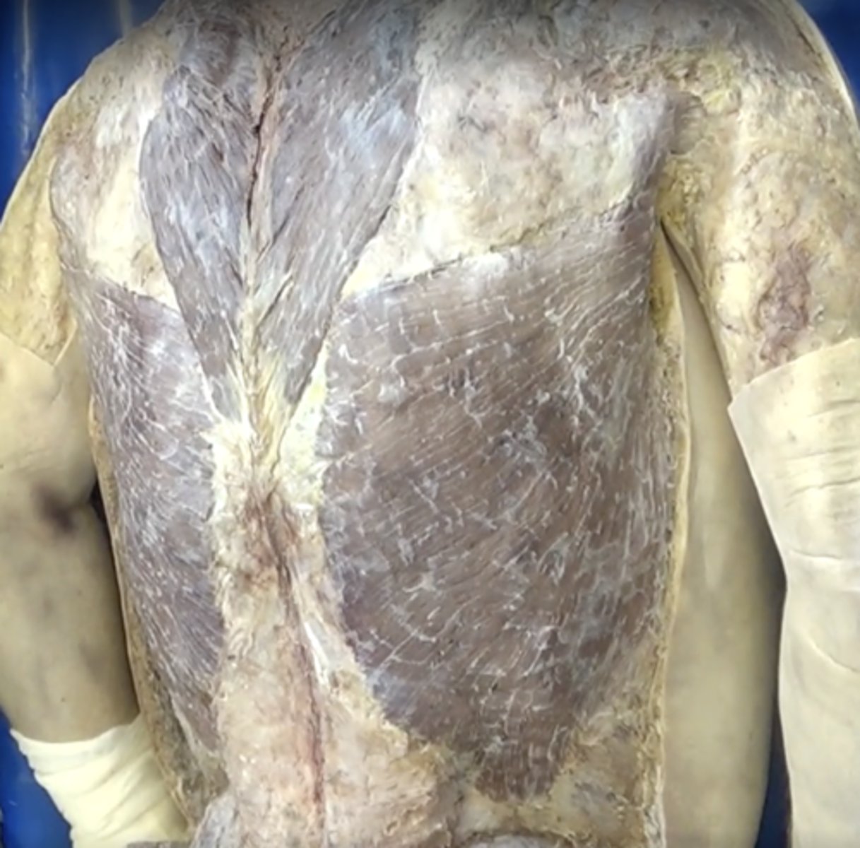 <p>Function: Extends and helps adduct upper arm, Insertion: Humerus, Origin: Vertebrae and illium</p>