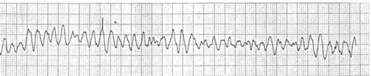 <p>D. Activate the emergency system or call 911</p><p>V-fib - ER and call 911</p>