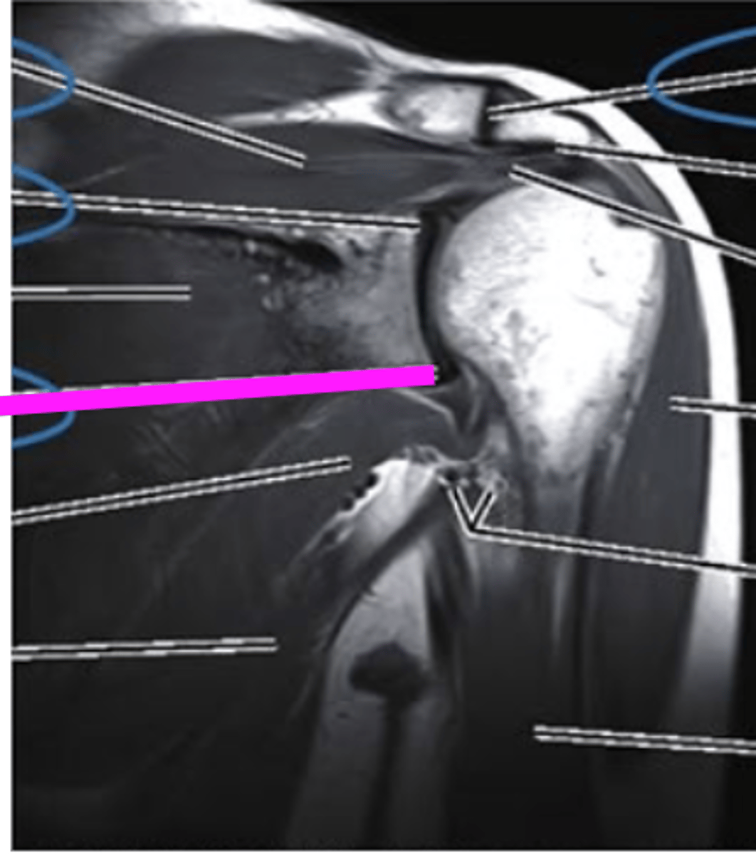 <p>what does the pink line point to?</p>