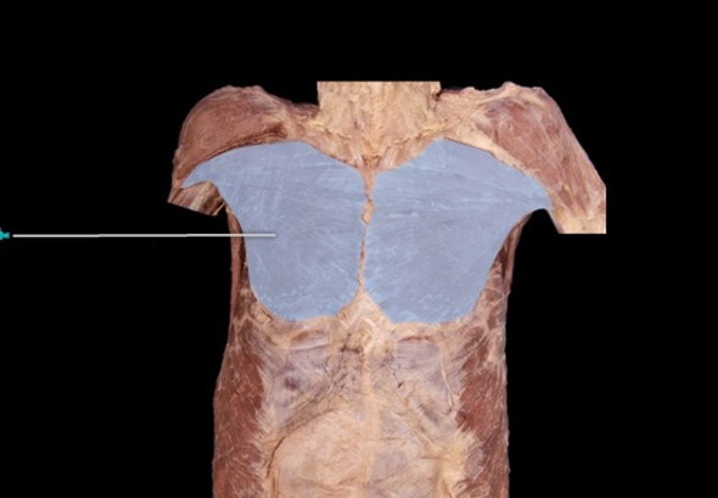 <p>What muscle is this?</p>