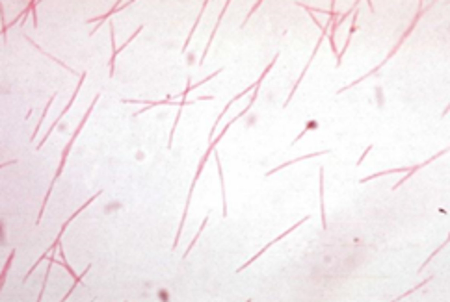 <p>· Reservoir: oral cavity and lower GIT</p><p>· Infections: recurrent tonsillitis, pharyngitis, Lemierre's syndrome, bacteremia</p>