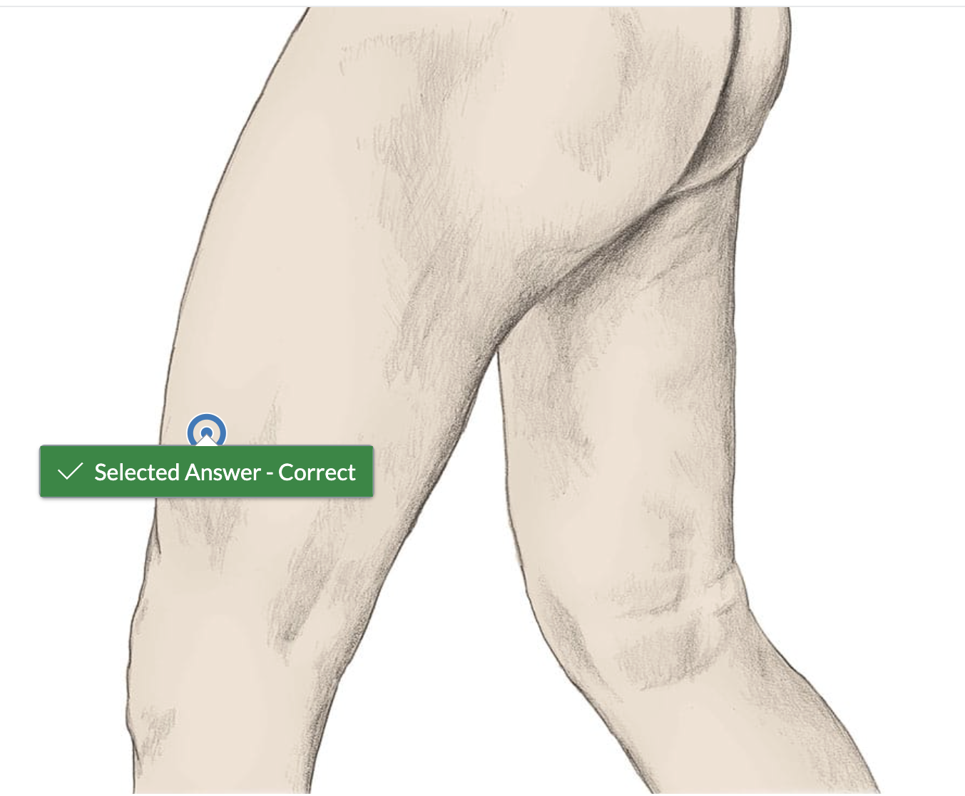 <p>lateral top knee</p>