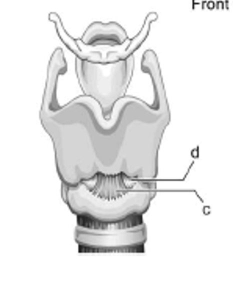 <p>label c - is it extrinsic or intrinsic?</p>