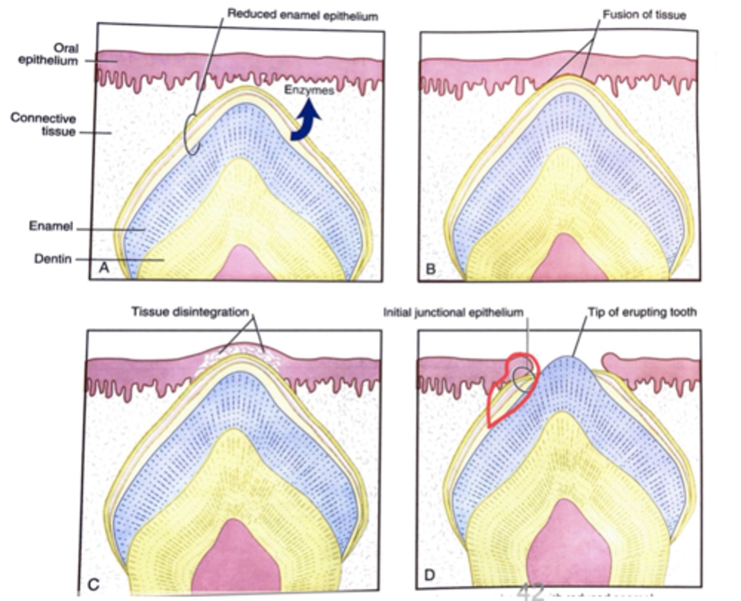 <p>1&gt;4&gt;3&gt;2</p><p>1) REE secretes enzymes </p><p>2) REE fuses with oral epithelium </p><p>3) REE enzymes degrade oral</p><p>epithelium</p><p>4) Junctional epithelium<strong> </strong>forms</p>