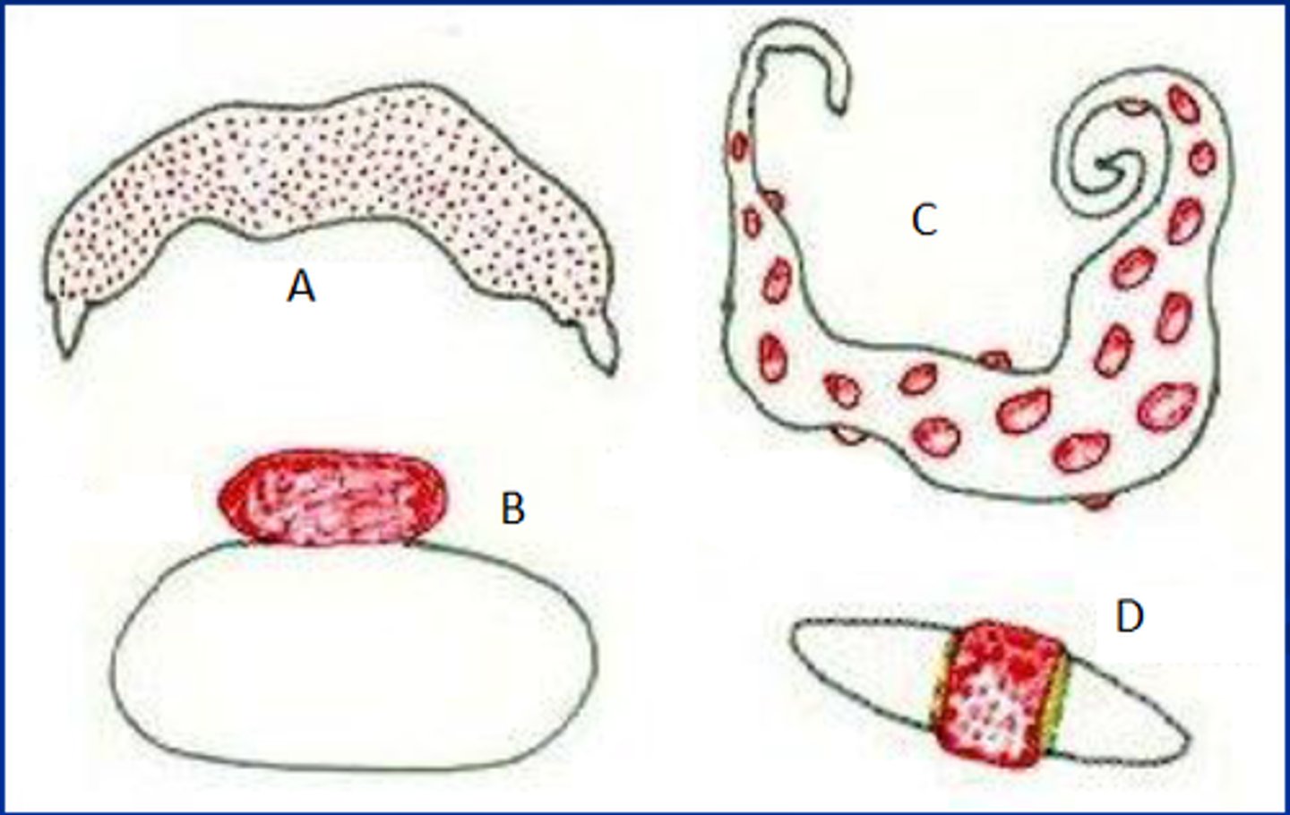 <ul><li><p>attachment sites are spread diffusely over surface of placenta</p></li></ul><ul><li><p>detaches easily</p></li></ul><p></p>