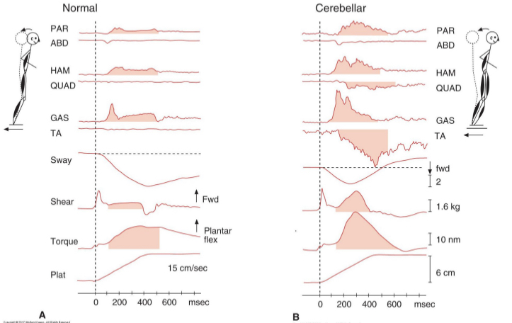 <p><strong>sway</strong> (see picture)</p>