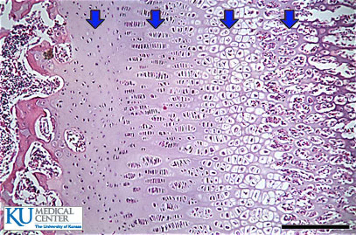 <p>surrounding cartilage matrix calcifies, chondrocytes die and deteriorate</p>