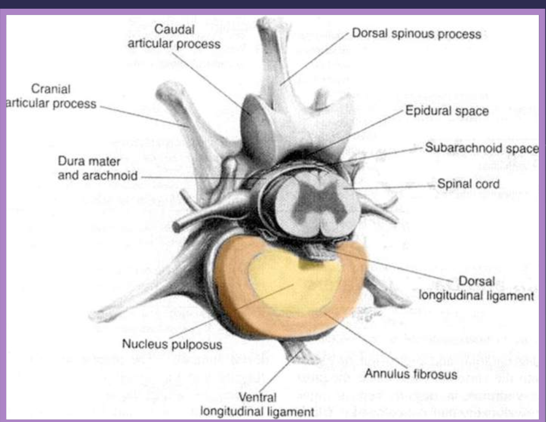 <ul><li><p>shock absorption and distribution </p><ul><li><p>determined by: </p><ul><li><p>proteoglycans in the nucleus </p></li><li><p>elasticity of the annulus </p></li></ul></li></ul></li><li><p>flexible enough to allow/rigid enough to endure: </p><ul><li><p>bending </p></li><li><p>shear </p></li><li><p>torsion </p></li><li><p>compression </p></li><li><p>tension </p></li></ul></li></ul><p></p>
