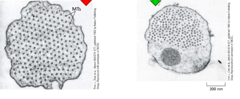 <p>The microtubules get EXCESSIVELY organized</p>