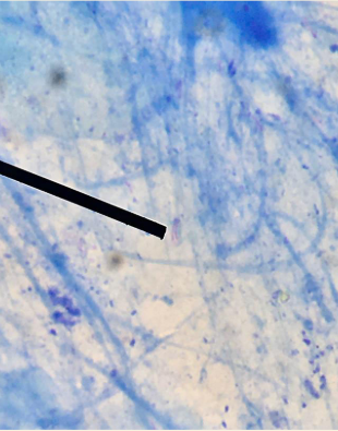 <p>Identify the morphology pointed at.</p>
