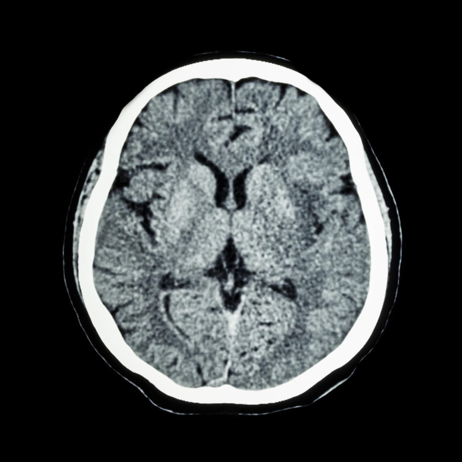 <p>Computed Tomography</p>