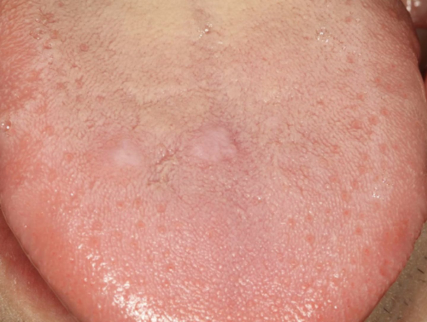 <p>What condition?</p>