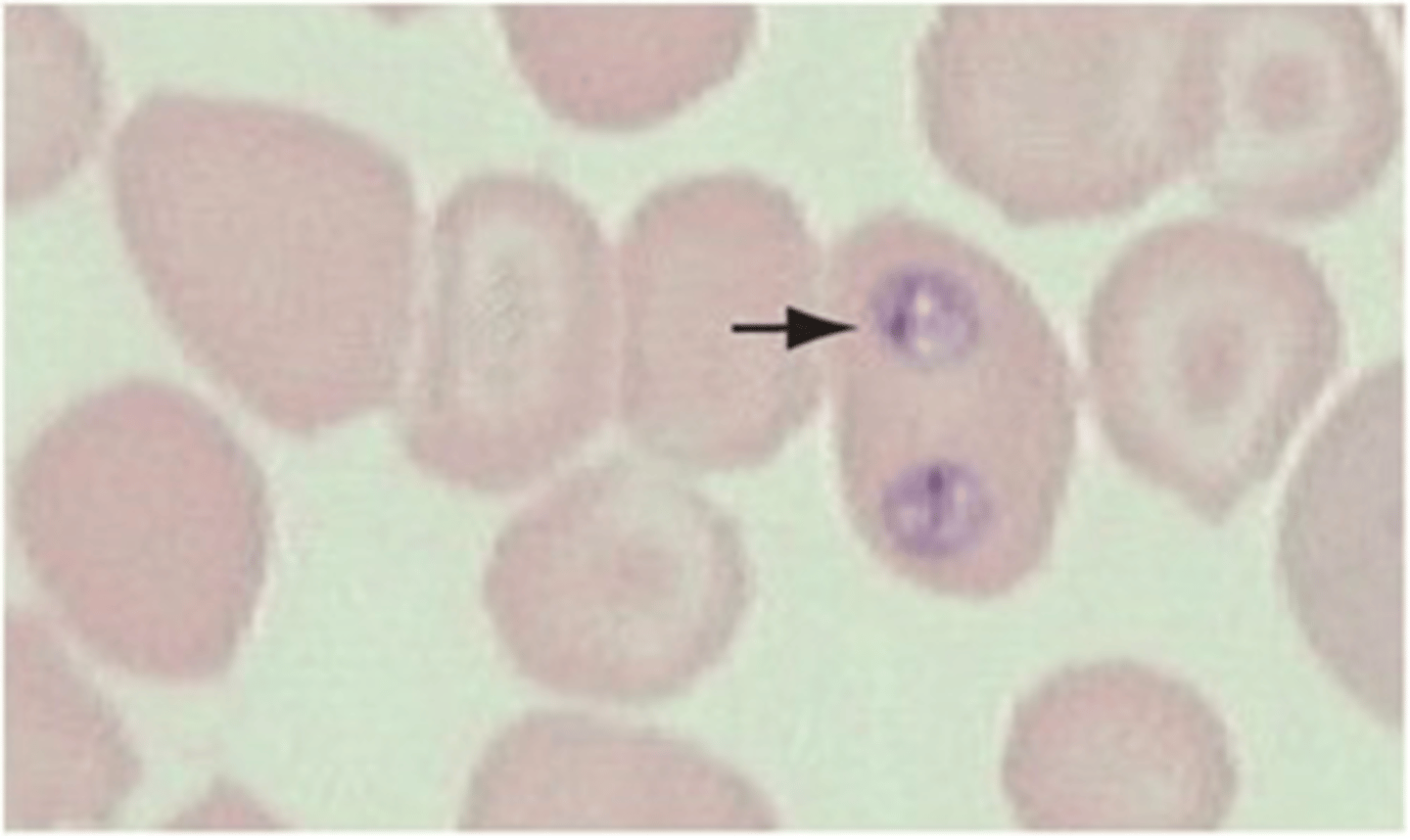 <p>This apicomplexan of dogs is seen in the red blood cells. It is called the canine piroplasm.</p><p>The genus and species is:</p>