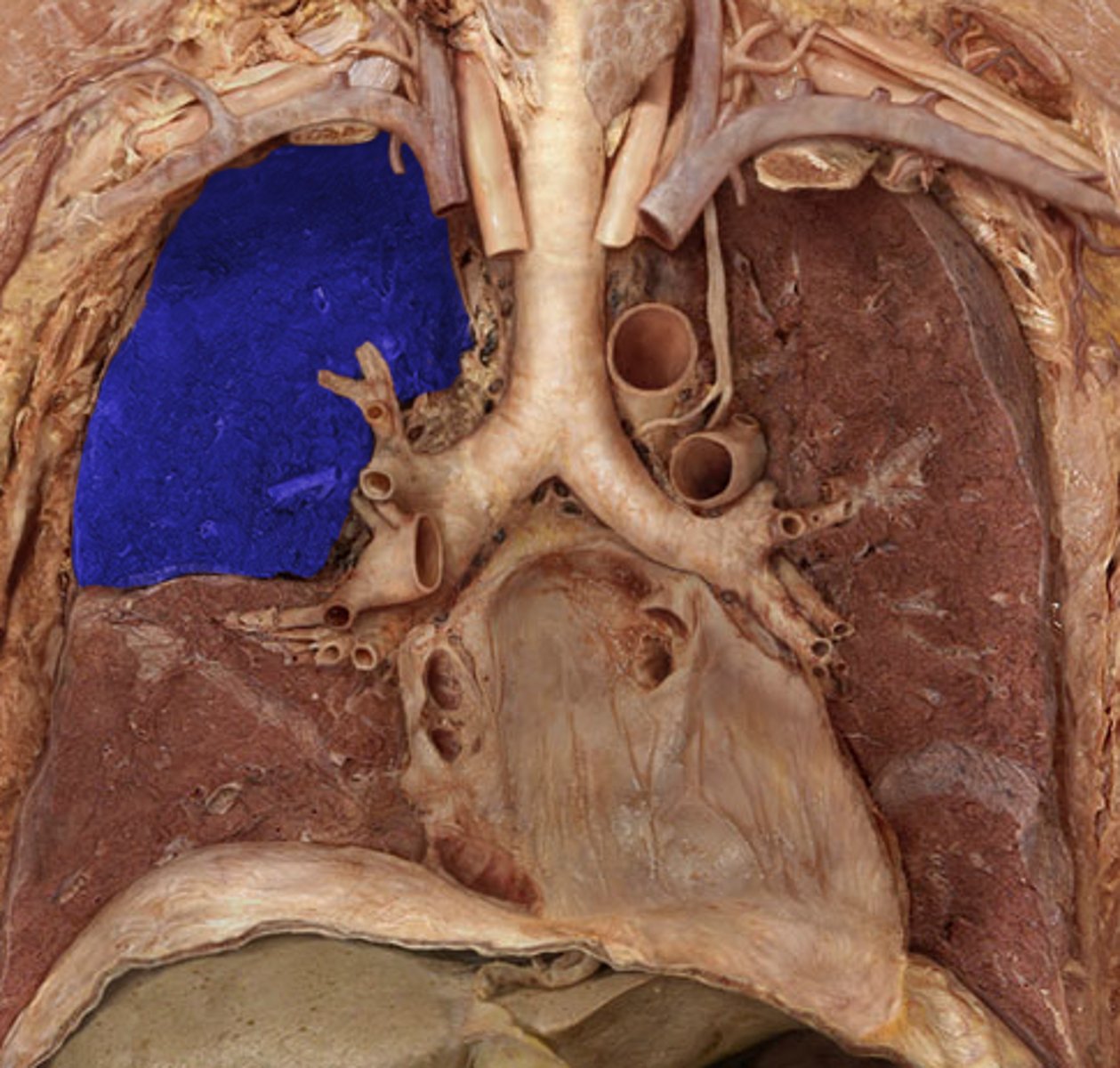<p>Label the Lung Segment</p>