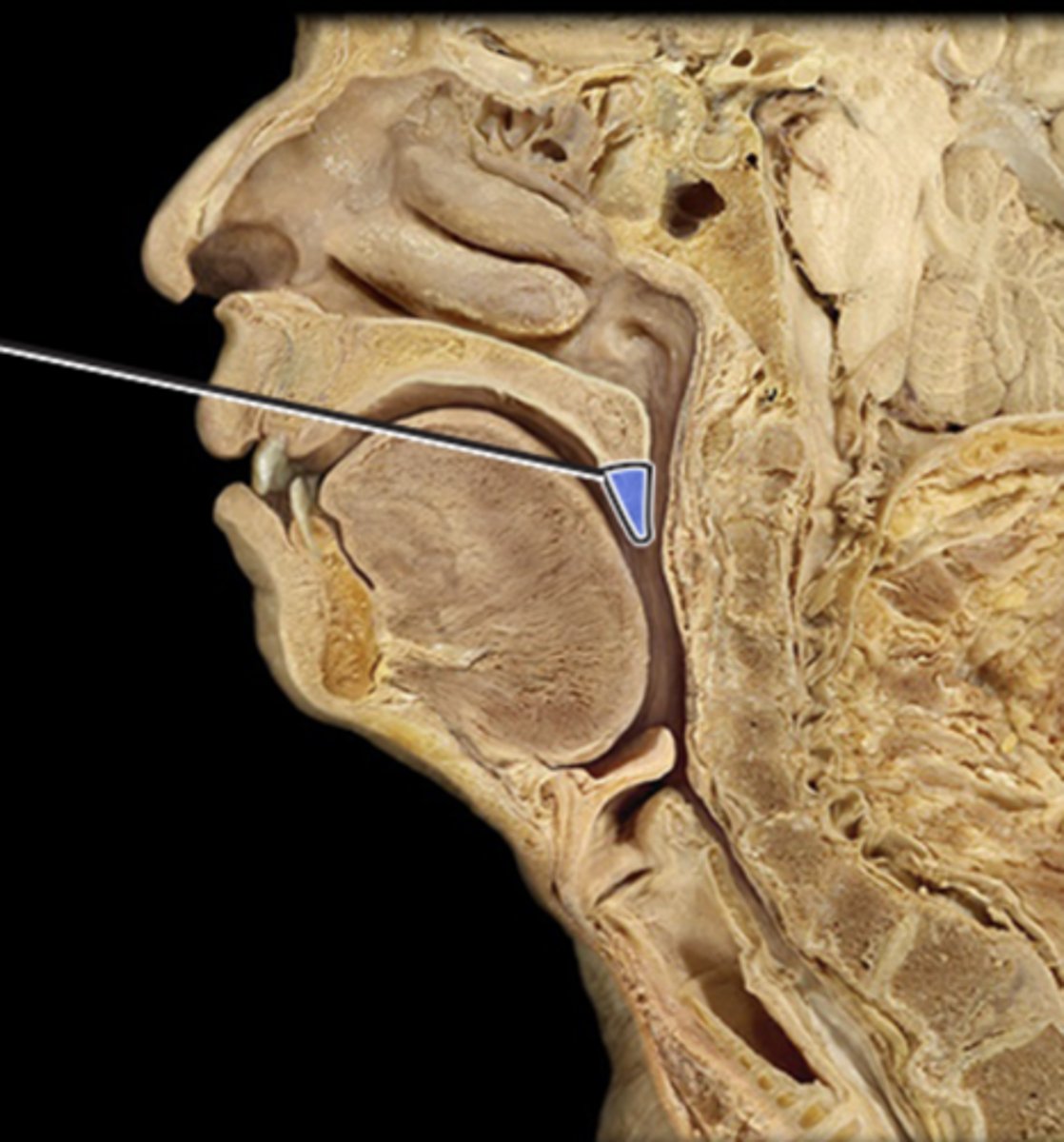 <p>the end of the soft palate, touching it evokes gag reflex</p>