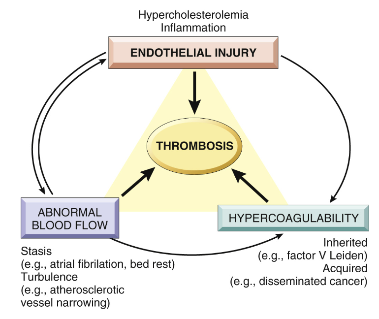 <p>Trombos kan bero på tre olika utlösande faktorer eller kombinationer av dessa:</p><ul><li><p><strong>Turbulent blodflöde</strong>: icke-laminärt, aterosklerotiska förändringar, immobilisering.</p></li><li><p><strong>Hyperkoagulabilitet</strong>: Kan vara medfött eller förvärvat och leder ofta till venös trombos.</p></li><li><p><strong>Endotelskada</strong>: Ofta associerat med arteriell trombos, beror på hyperkolesterolemi och inflammation.</p></li></ul>