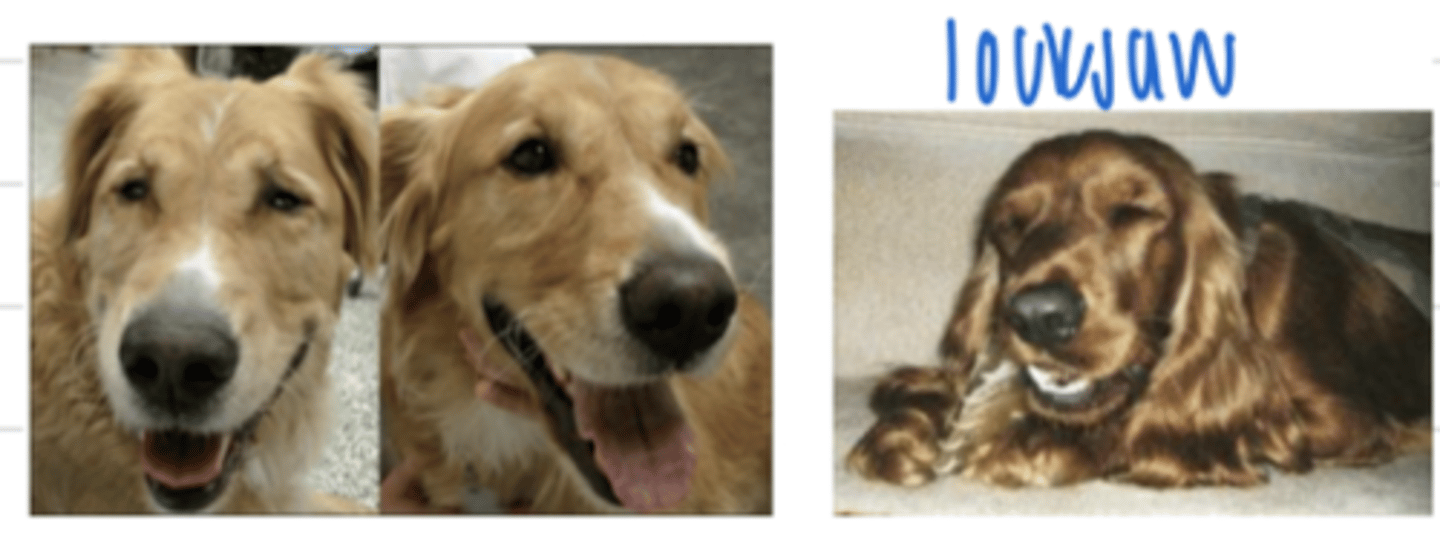 <p>muscle tremors and lock jaw is the affect of what bacteria?</p>