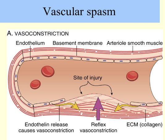 <p></p><ul><li><p>Vessel responds to injury with vasoconstriction</p></li><li><p><span style="color: green;"><strong><mark data-color="green" style="background-color: green; color: inherit;">Vascular spams are triggered by:</mark></strong></span></p><ul><li><p>Direct injury to vascular smooth muscle</p></li><li><p>Chemicals released by endothelial cells and platelets</p></li><li><p>Pain reflexes</p></li></ul></li><li><p><span style="color: red;"><strong>Strongly constricted artery can significantly reduce blood flow until other mechanisms can kick in</strong></span></p></li></ul><ul><li><p><span style="color: blue;"><strong>Most effective in smaller blood vessels</strong></span></p></li></ul><p></p>