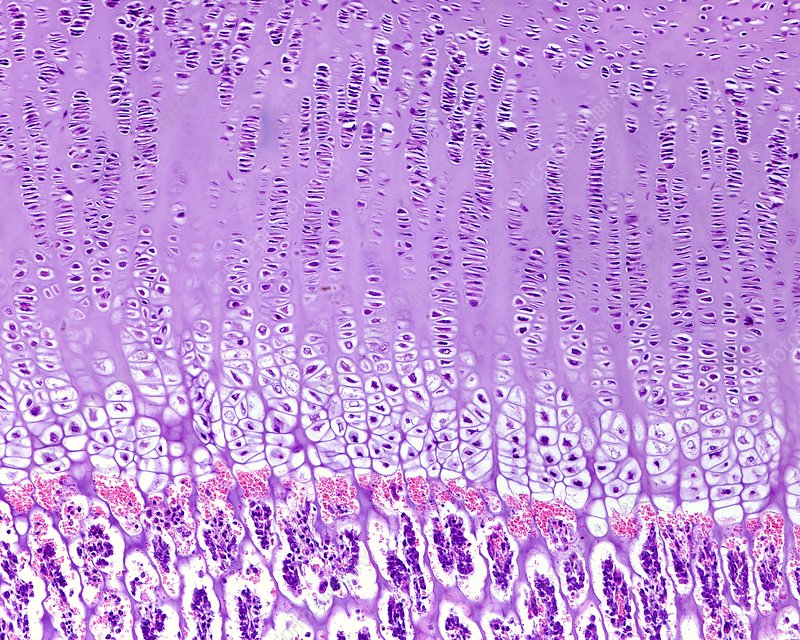 <p>what are the zones in endochondral ossification</p>