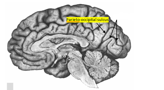 <p>what sulcus is this?</p>
