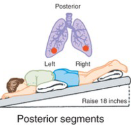 <p>What CPT position is pictured, and when is it used?</p>
