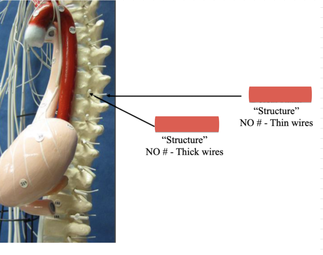 <p>Label structure (thick wires)</p>