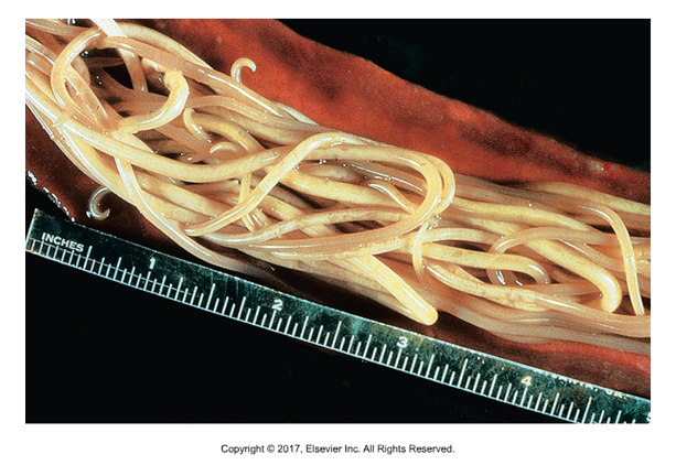 <ul><li><p>Found: Worldwide​</p></li><li><p>Cause of infection: Ingestion of infective ova​</p></li><li><p>Not zoonotic​</p></li><li><p>5mm wide and 41 cm long​</p></li><li><p>Adults can be passed in feces, can cause bowel obstruction​</p></li><li><p>Eggs passed in feces and hatch in environment as infective larvae​</p></li><li><p>Larvae hatch and migrate to liver, molt, migrate through blood to lungs, coughed up and swallowed.​</p></li><li><p>Adults mature in small intestine​</p></li><li><p>Symptoms: Reduced weight, unthriftiness, respiratory symptoms in pigs</p></li></ul><p></p>