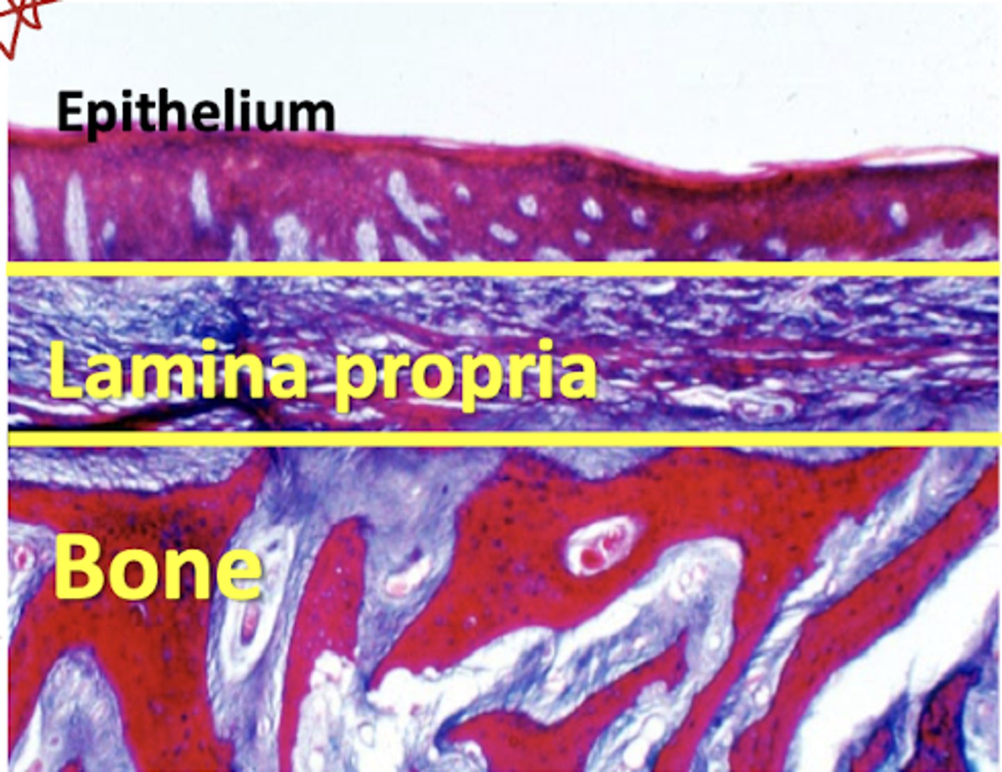 <p>true, </p><p>-lamina propria is attached to periosteum of underlying bone forming a mucoperiosteum</p>