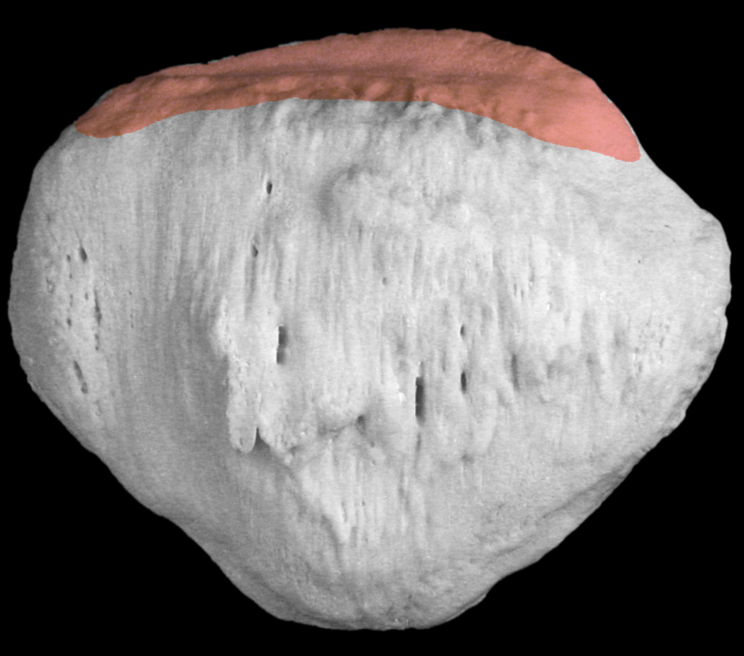 <p>flatter superior portion of patella </p>