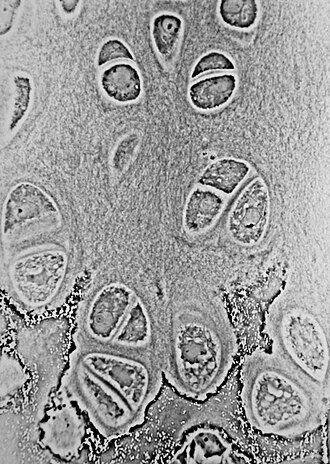 <p>found in all types of cartilage</p><p>mature cartilage cell that produces and maintains the cartilage matrix (collegen + elastic fibers)</p>