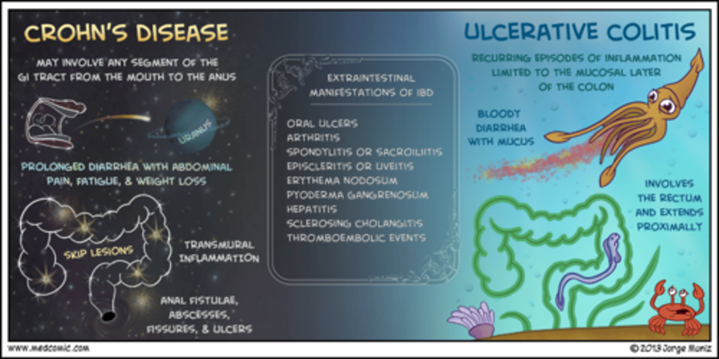 <p>- occurs anywhere in GI tract: mouth to anus</p><p>- terminal ileum most common</p><p>- transmural inflammatory process with deep ulcers</p><p>- fistula, perforation, or obstruction are more common</p>