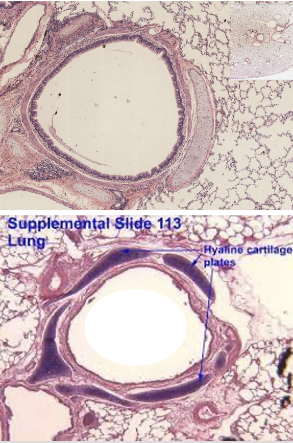 •Ciliated pseudostratified columnar epithelium

•Goblet cells producing mucus

•Primary bronchi will have complete rings of cartilage

•Secondary-Tertiary will have irregulate plates of cartilage

•Increasing layers of smooth muscle