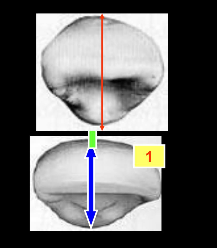 <p>what dimension is greater?</p>