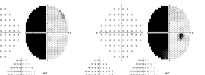 <p>What is this VF plot showing</p>
