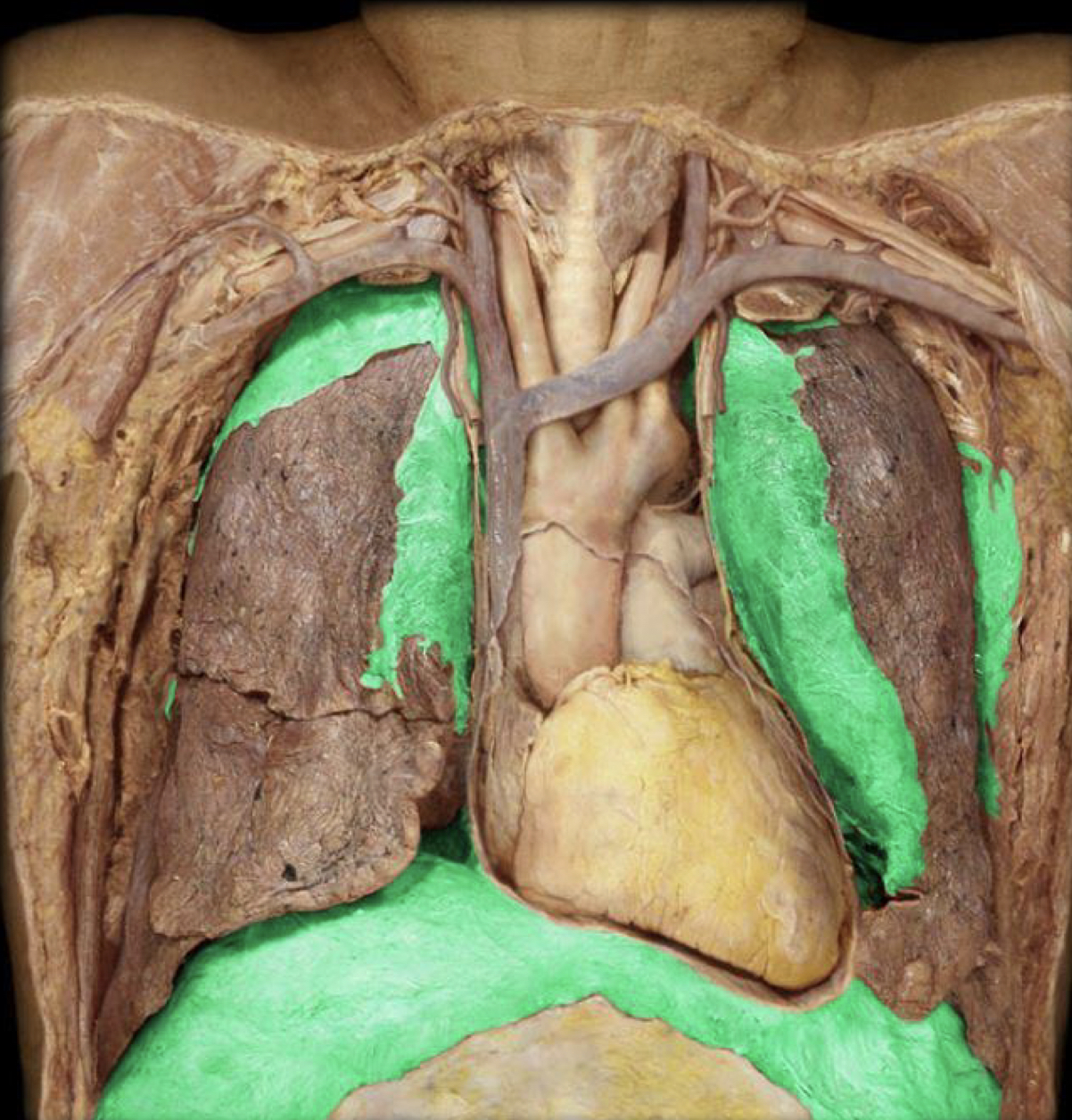 What structure is highlighted in green?